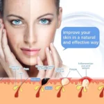 High Frequency Wand Portable Skin Care Device - Image 4